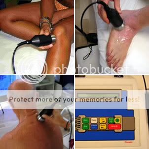 Artrosi: la terapia fisica parte 2^ ultrasuoni1 Artrosi: la terapia fisica parte 2^